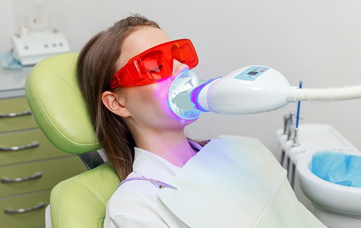 Diş Beyazlatma (Bleaching) Yöntemleri: Ofis Tipi mi Ev Tipi mi?