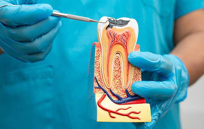 Kanal Tedavisi Ağrılı Bir İşlem midir?